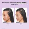 Lemme Grow Hair Growth Supplement for Women, Clinically Proven Keratin Complex for Visibly Thicker Hair and Scalp Coverage, Reduced Shedding, Nourish Thinning Hair – 1 Month Supply